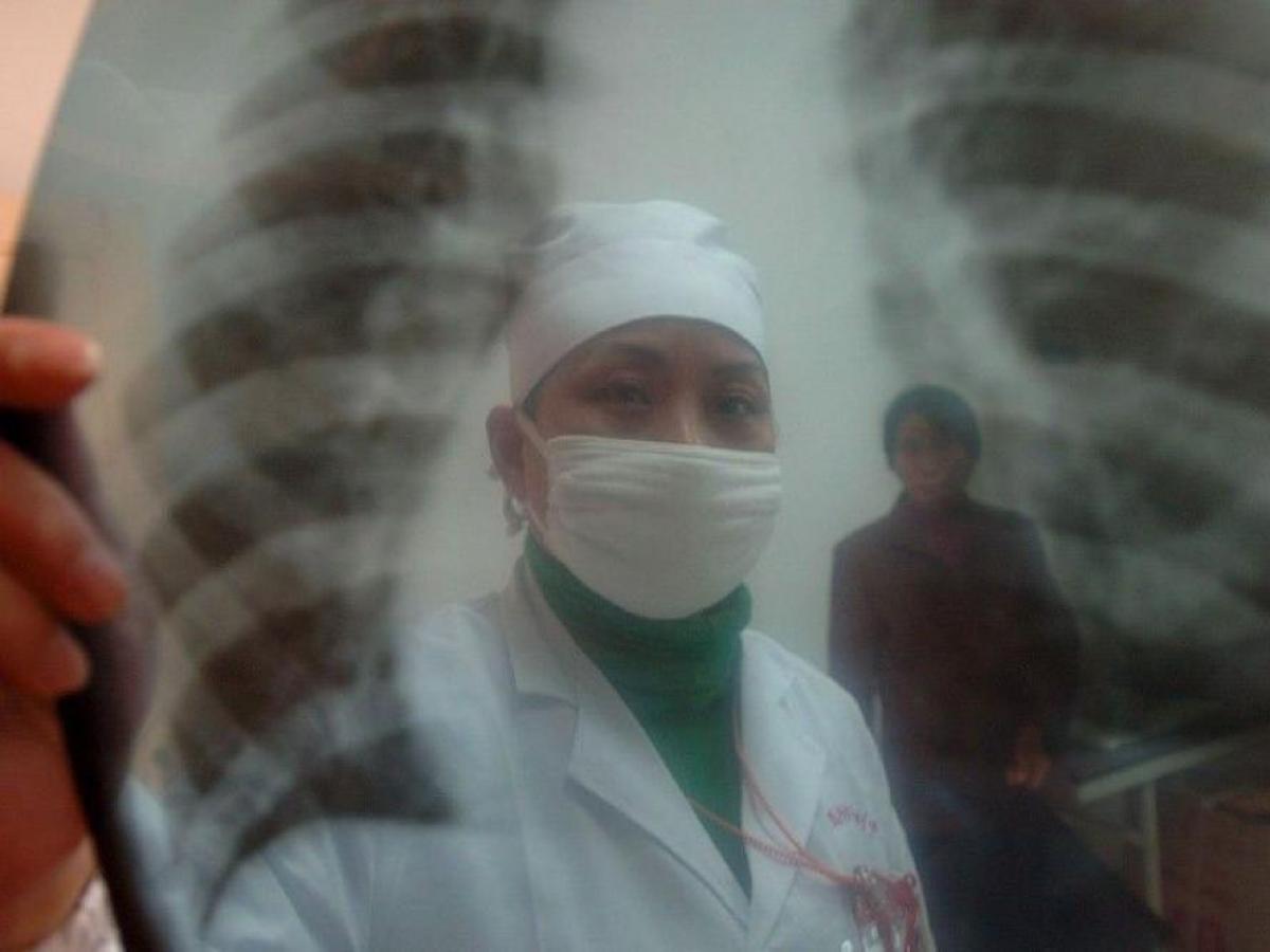 Туберкулез Кыргызстан